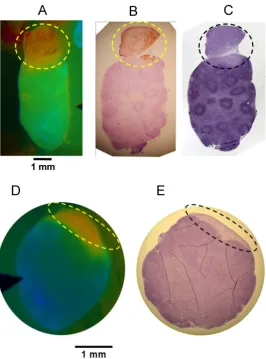 Figure 6. Oriented Fluorescence Imaging and Histopathology. Representative mouse in vivo FR images and corresponding oriented histopathology sections of metastatic cervical lymph nodes in mice administered AVB-620