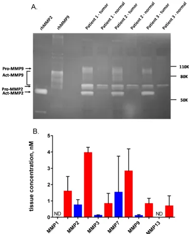 Figure 8. Quantification of MMPs in non-malignant breast tissue and tumor homogenates