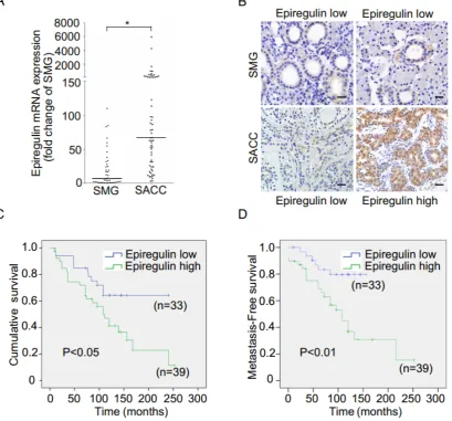 Figure 1. Expression of epiregulin is upregulated in SACC and is correlated with poor clinical outcome