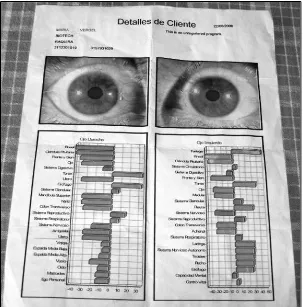Figure 10. The anatomy of potters‟ envy as shown by the eye test exam. 