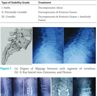 Table 2  Therapeutical guideline according to the stratification of the grades in stability