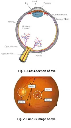 Fig. 2. Fundus Image of eye. 
