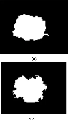 Figure 6. (a) Original ultrasound benign image; (b) NESRAsegmentation.