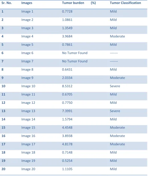 TABLE  II. Tumor Burden Analysis using Otsu 