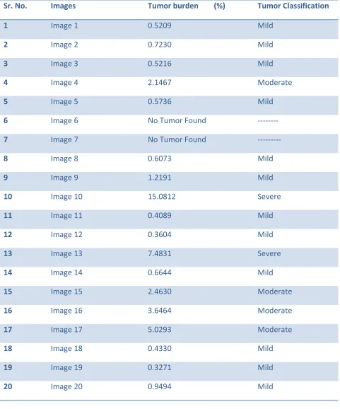 TABLE  IV. Tumor Burden Analysis using FCM 
