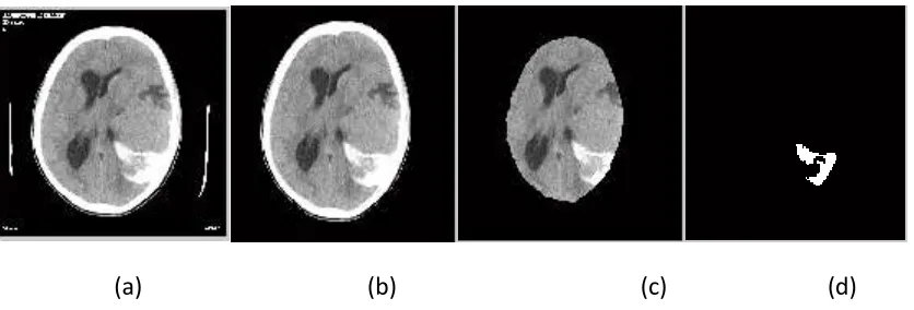 Figure 2 Patient information removal (a)original Image (b) Image without text (c) Text separated    