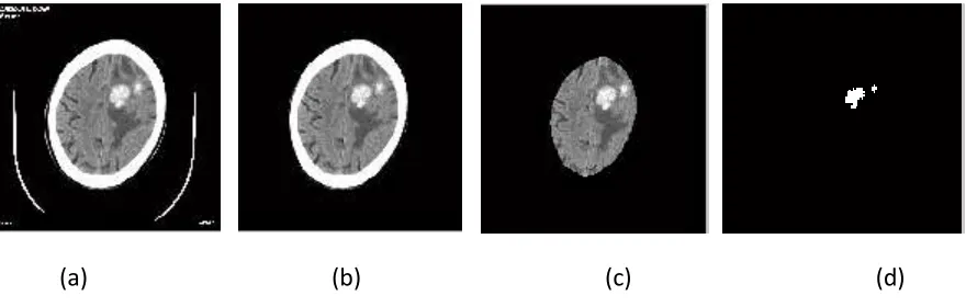 Figure 4 (a) original Image (b) Image without text (c) Brain tissues with abnormality (d) Abnormal   