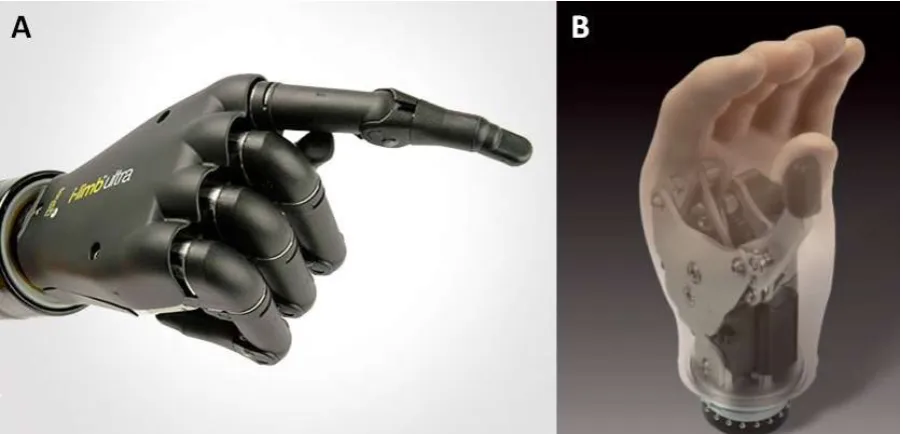 Figure 2. 13: (A) i-Limb™ Ultra from Touch Bionics (from (90)), (B) Select Myo Electric hand from RSL Steeper (from (91))