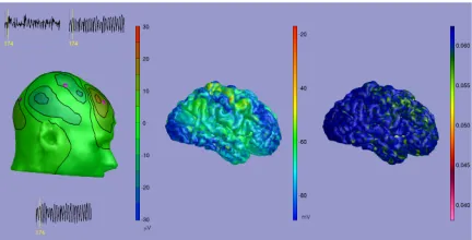 Figure 8: An EEG scalp isopotential (left) generatedfrom the mean membrane excitatory potential of aneural ﬁeld model (middle) and the correspondingfMRI BOLD signal construction on the cortical surface(right), illustrating the capabilities of the recent co