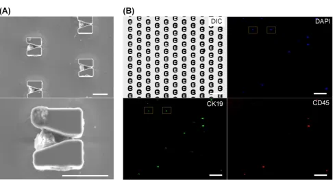 Figure 4. Immunofluorescent identification of CTCs from a clinical blood sample. (A) SEM images of EpCAM-positive cells from a blood sample positioned in V-shaped microstructures
