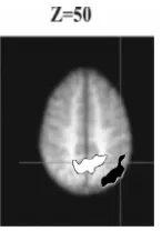 Fig. 6. Comparisons between the standard preview condition and the condition whereﬂect correlations between (i) top-down inhibitory activity in sSoTS and (ii) increasedpreview search was conducted with a working memory load (the loaded search condi-tion) [