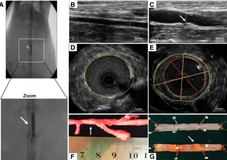 Figure 6. Atherosclerotic lesions. (A) Abdominal aorta balloon denudation model. (C) Representative ultrasound images show the vessel enlargement and plaque (D) but not in control group