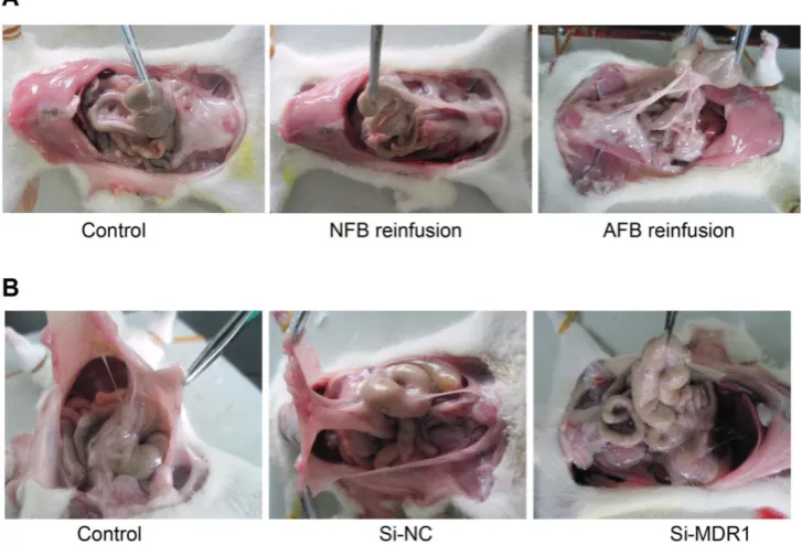 Figure 2. Overexpression or Knockdown of P-gp Promotes or Degrades Peritoneal Adhesion in a Rodent Model, Respectively