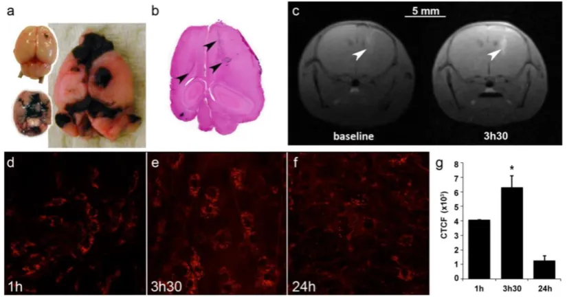 Figure 4. Brain tumor distribution of AGuIX®. (a) Mouse brains 5 and 10 days after B16F10 implantation and (b) the corresponding H&S section