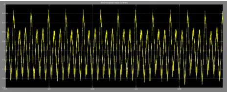 Fig -4(ii) a: Output waveform for speed 