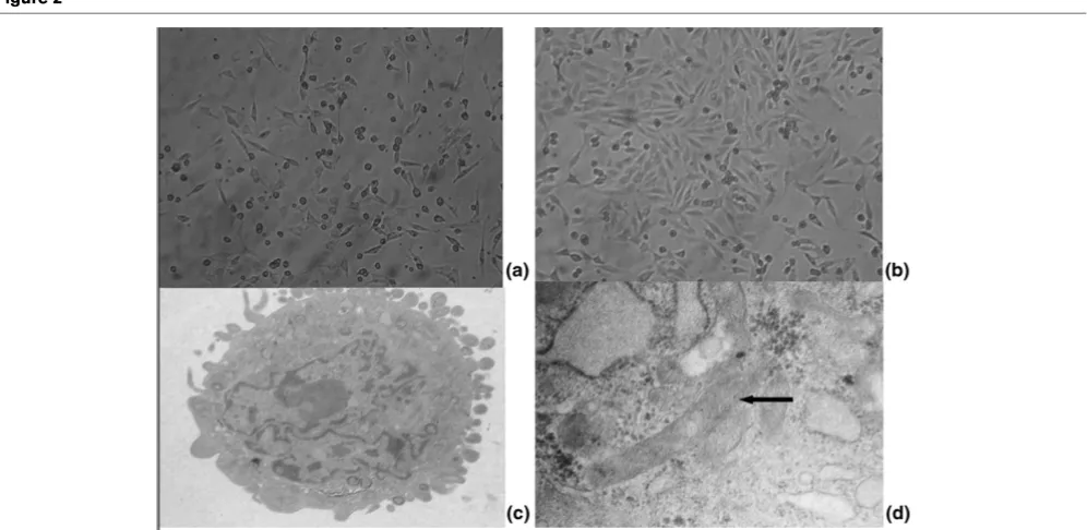 Figure 1Number of endothelial progenitor cells during progression of multiple organ dysfunction syndromes(left) peripheral blood and (right) bone marrow