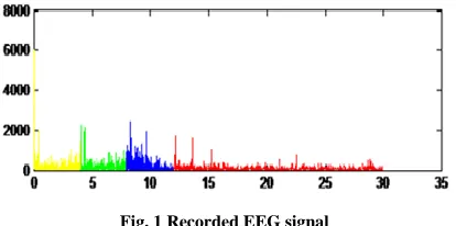 Fig. 1 Recorded EEG signal 