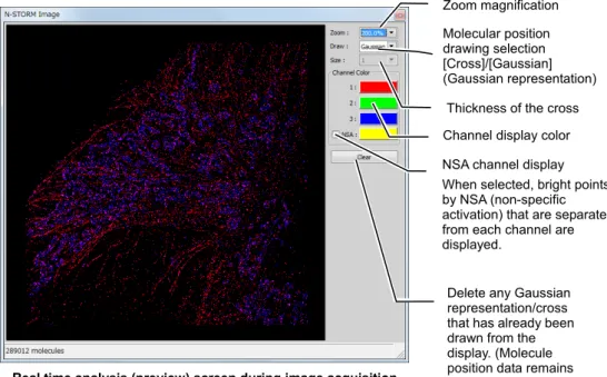 Graphic screen during image acquisition 