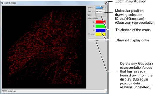 Graphic screen during image acquisition 