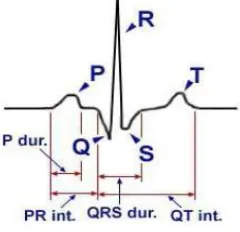 Figure 2.2 ECG feature extraction 