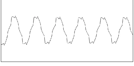 Fig 5. Voltage Unbalance 