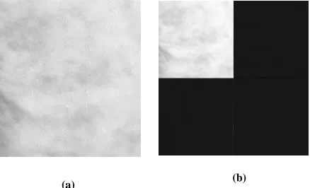 Figure 2.1: (a) Sample mammogram image (b) 2-D Wavelet decomposition 