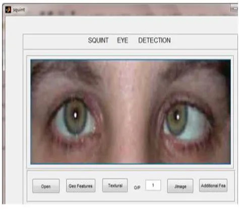 Fig 6: Extraction of Geometric Feature Of selected Eye 