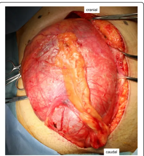 Fig. 4 Gross photograph. Sectioning revealed a multicysticcut surface