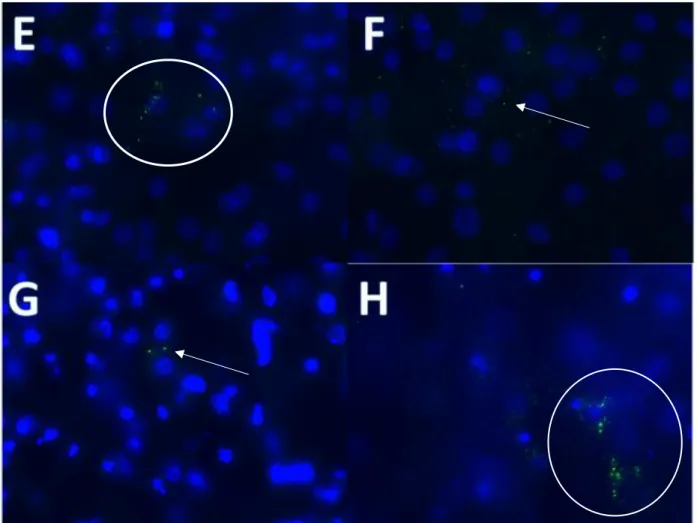 Fig. 12 Immunofluorescence imaging of ZO-1. E) Gö 6976 show tight junctions separating two esophageal cells F)  anti-TSLP EOS show dispersed tight junction proteins, leading to decreased epithelial resistance G) anti-TSLP DM  shows retained epithelial resi