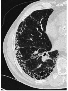 Figure.1 Original image   