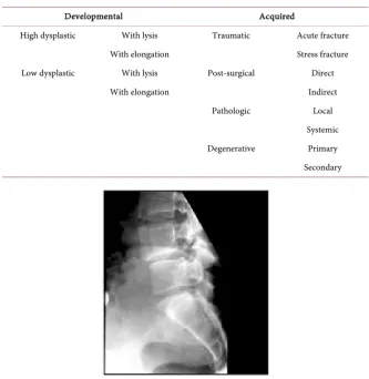 Table 1. Spondylolisthesis classification proposed by Marchetti and Bartolozzi. 