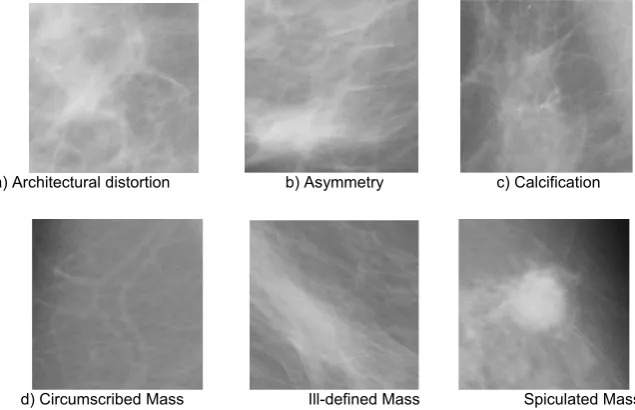 Table 2: Classification techniques and features for mammograms 