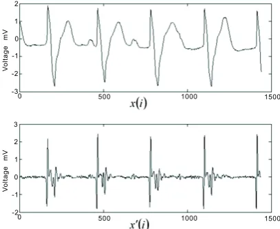 Figure 3. ECG signal and corresponding different signal.