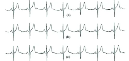 Table 1, the proposed method is compared with 