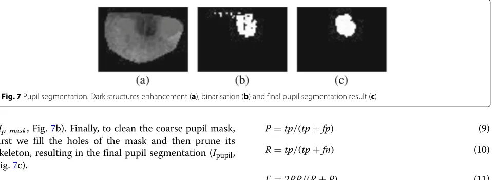Fig. 7 Pupil segmentation. Dark structures enhancement (a), binarisation (b) and final pupil segmentation result (c