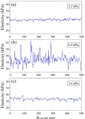 Fig. 3. Elasticity measurements performed on a homogeneous silicone phantom, using (a) the mounted setup with the custom scan pattern, (b) the handheld setup with the standard scan pattern and (c) the handheld setup with the custom scan pattern