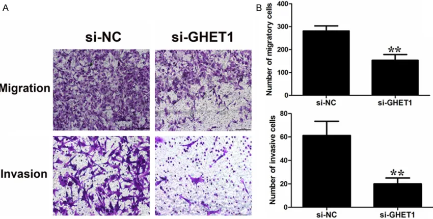 Figure 3. Knockdown of GHET1 may inhibit the proliferation of bladder cancers via inducing G0/G1 arrest