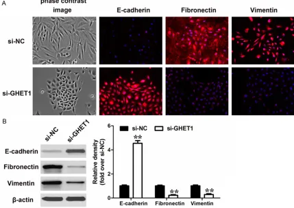 Figure 6. Effect of GHET1 on the EMT-related TFs. Western-blot analysis of EMT-related TFs after GHET1 knockdown in T24 cells
