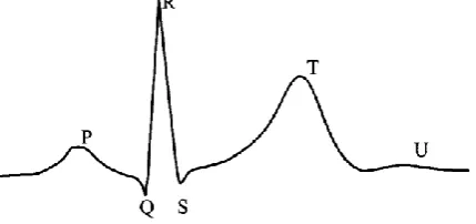 Fig. 1. Elements of the ECG-complex 