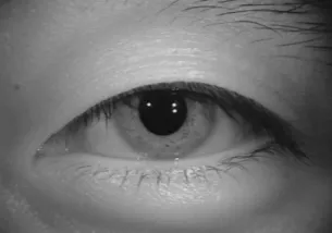 Fig.5 Noise elimination (eyelid and eyelash)   