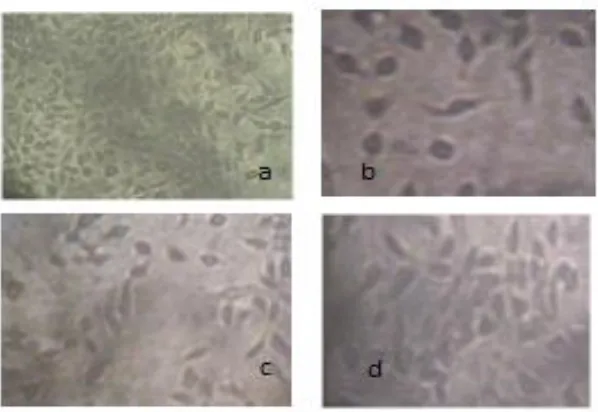 Figure 9. In vitro cytotoxic activity of PDDS on A549 (lung cancer) cell line at different concentrations (a) Normal cell, (b) 1000 µg/ml, (c) 125 µg/ml and (d) 7.8 µg/ml ACKNOWLEDGEMENT 
