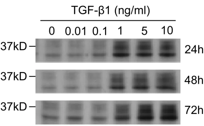 Figure 6βTGF-TGF-1 induces CTGF expression in A549TGF-β1 induces CTGF expression in A549