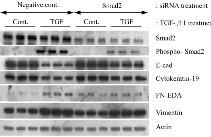 Figure 9βregions of Smad2 were transfected into A549 cells at 50 pmol per well. 24 h after transfection, cells were stimulated with 5 ng/Effect of Smad2 siRNA on TGF-1 induced EMT in A549 cellsEffect of Smad2 siRNA on TGF-β1 induced EMT in A549 cells