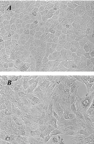 Figure 2Morphological changes induced by TGF-β1Morphological changes induced by TGF-