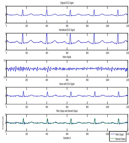 Figure 01: ECG File load ('4.txt') with “Motion Artifact” Noise. 