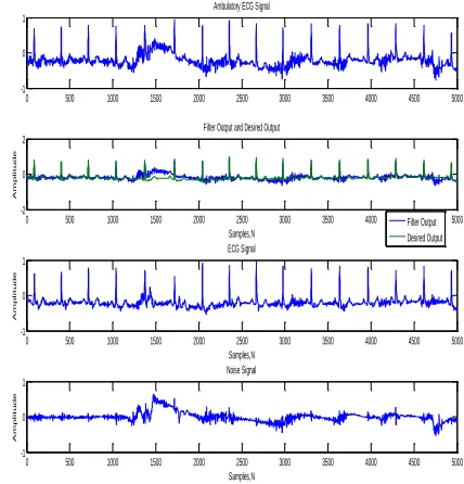 Figure 03: Simulating ECG as well as Motion Artifact for given physical activity CASE III