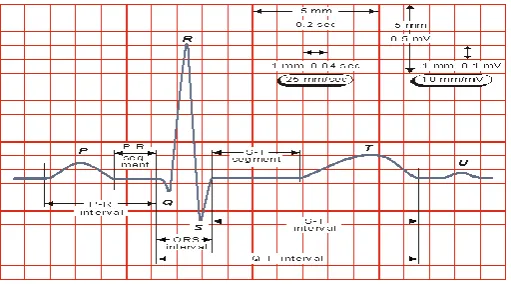 Fig .1 The electrocardiogram 