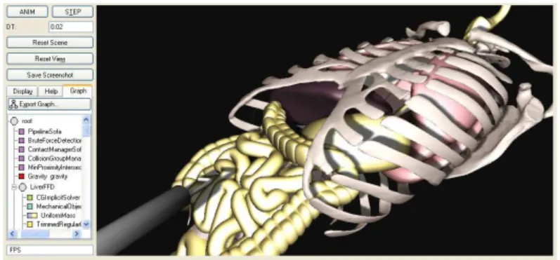 Figure 3. Simulation of laparoscopic surgery using SOFA at interactive rates (about 50Hz).