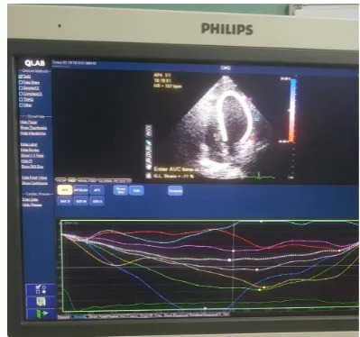 Figure 2. Left ventricular global longitudinal strain 3 months after PCI. 