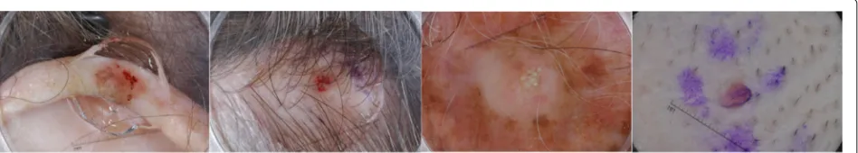 Fig. 1 Sample dermoscopic images from the ISBI 2017 Challenge: Skin Lesion Analysis Toward Melanoma Detection